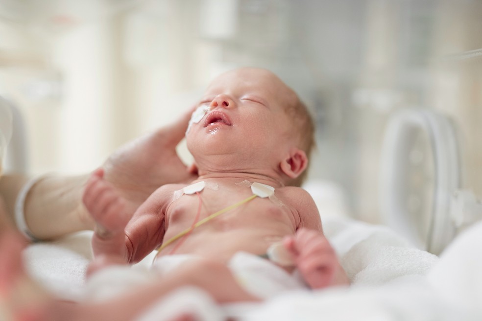 A cerclagem oferece mais chances de sobrevivência dos bebês prematuros — Foto: Getty Images