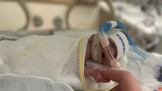 Bebê que nasceu pesando apenas 450 gramas vai para casa após 181 dias no hospital