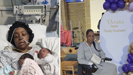 Após dar à luz gêmeos, mãe enfrenta amputação do braço, pernas e mão