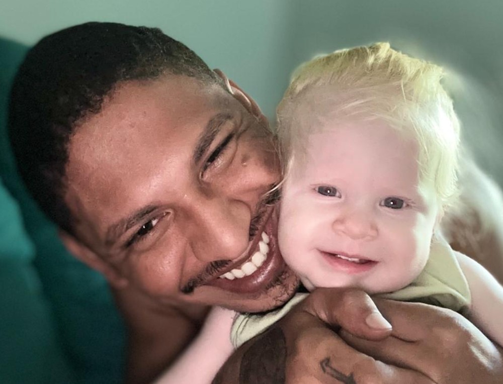 psicologiasdobrasil.com.br - &lsquo;Ela &eacute; de quem?&rsquo;: pai negro exp&otilde;e os coment&aacute;rios cru&eacute;is que ouve por ter filha albina