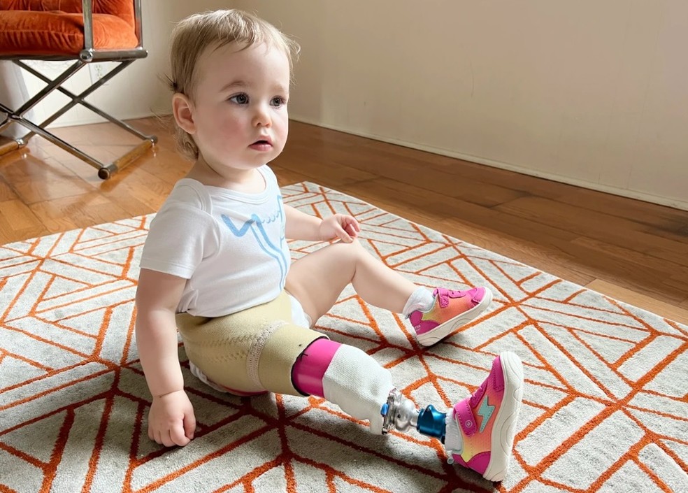 Isa começou a usar uma perna protética — Foto: Reprodução/Today