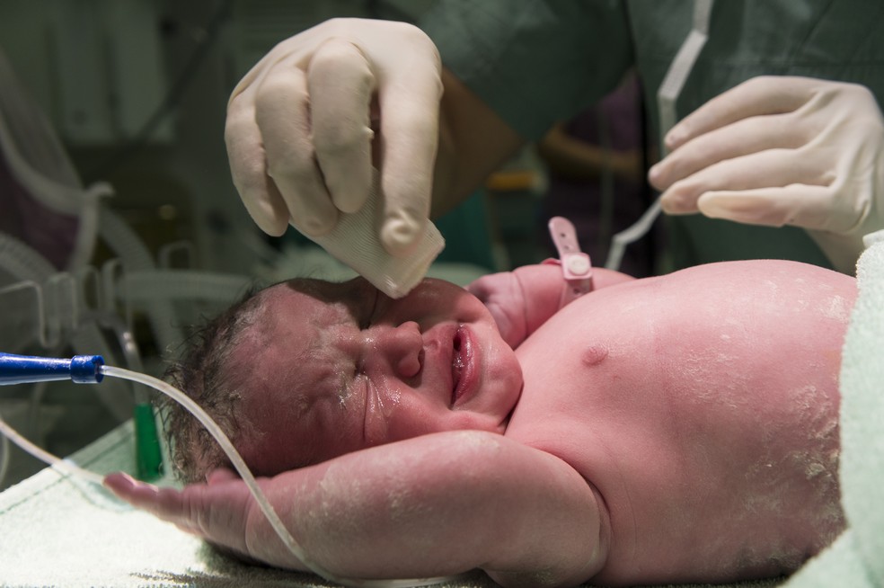 Recém-nascido na sala de parto — Foto: Freepik
