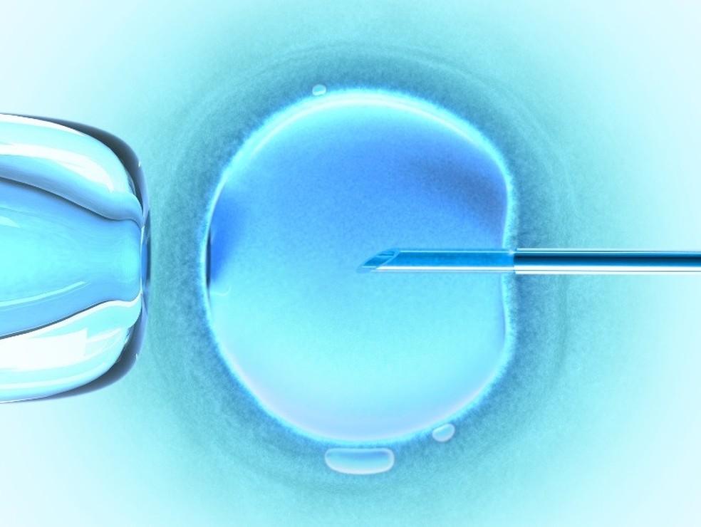 Fertilização in vitro (Foto: Getty Images) — Foto: Crescer