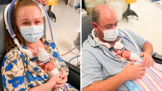 Prematuridade: “Meu bebê nasceu com 670 g, mas nunca parou de lutar”