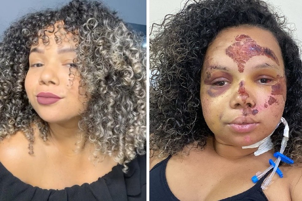 Mãe se joga de coletivo em movimento, no RJ: 'Comecei a gritar ...