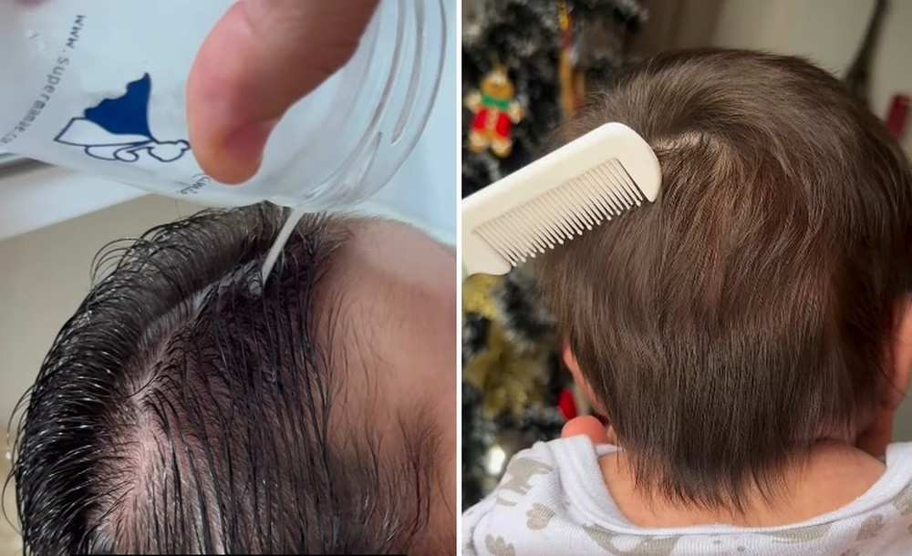 Leite Materno Cabelo Do Bebe