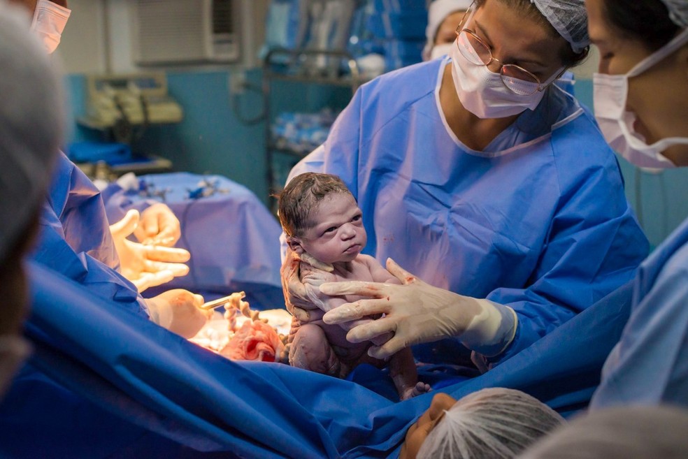 Bebê nasce com cara de "brava" e viraliza (Foto: Rodrigo Kunstmann) — Foto: Crescer