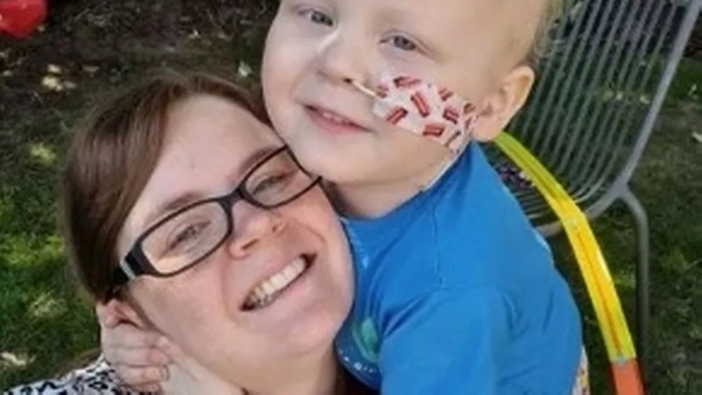 Vicky Winn pensou que as bochechas inchadas de seu filho eram causadas por uma reação alérgica — Foto: Reprodução Mirror