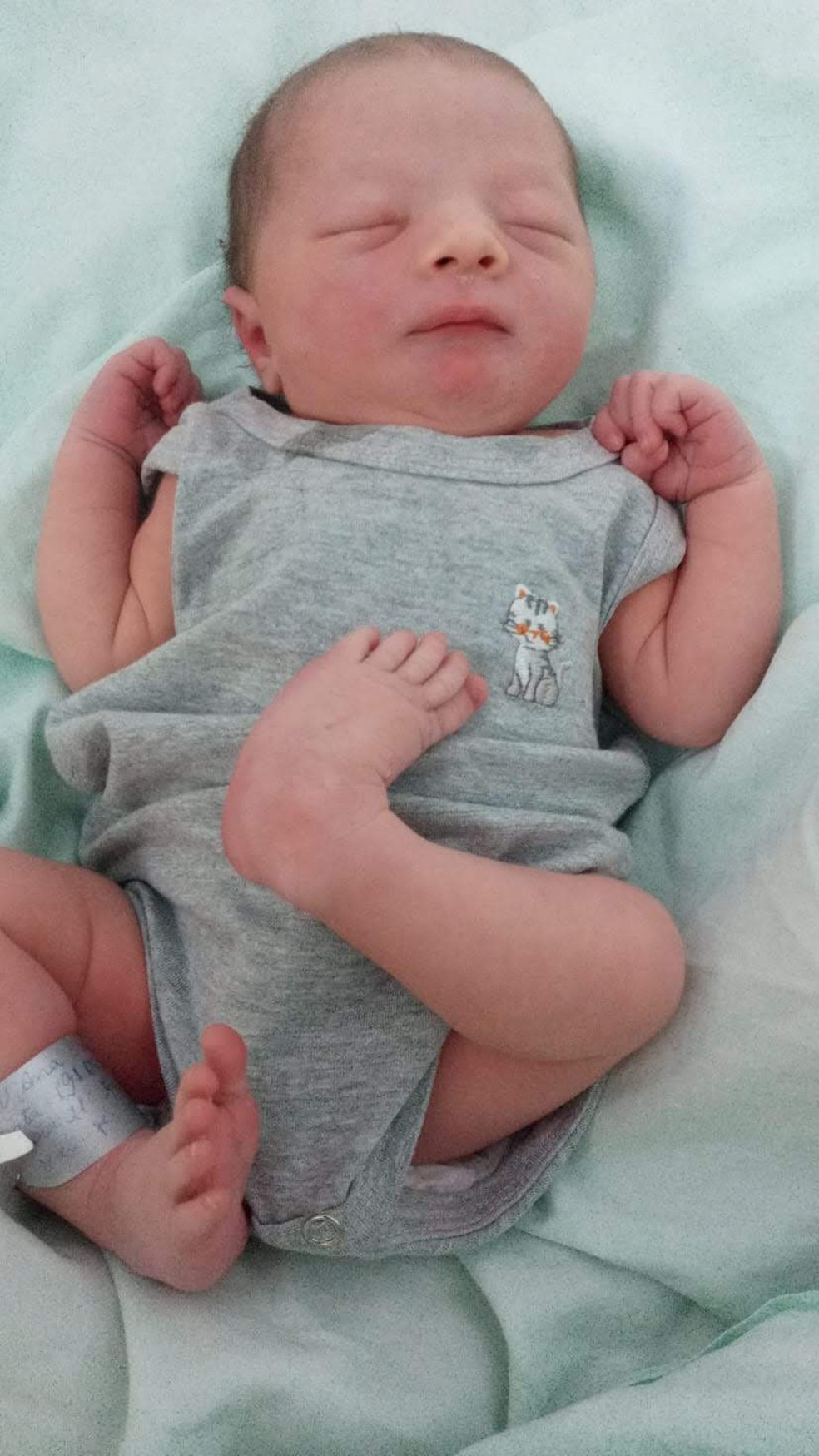 Lunna nasceu com p&eacute; torto cong&ecirc;nito &mdash; Foto: Arquivo pessoal