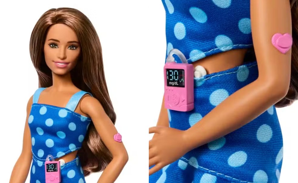 Barbie lança primeira boneca com diabetes tipo 1: veja os detalhes