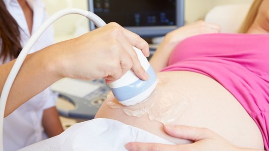 É possível ter parto normal em uma gravidez de gêmeos?