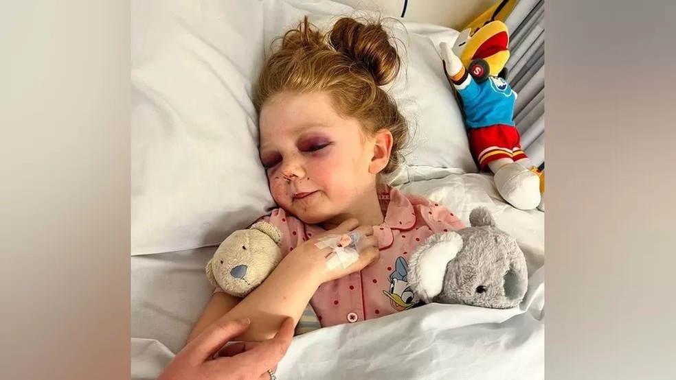 A menina foi atingida por uma enorme bola inflável — Foto: Reprodução/ BBC