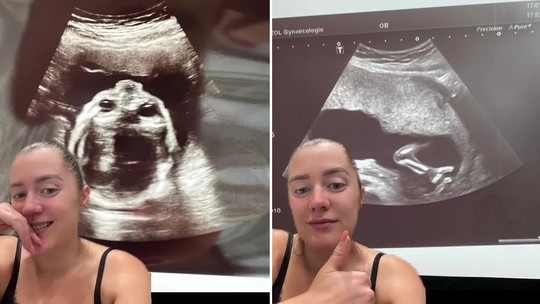 Grávida se assusta com imagem "aterrorizante" em ultrassom