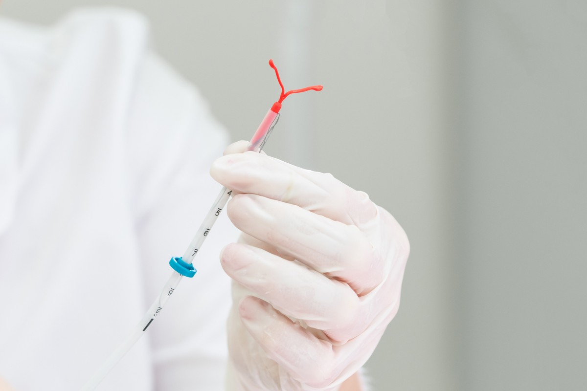 Mirena: DIU Hormonal Ganha Aprovação para Uso de Até 8 Anos no Brasil! Veja os Benefícios