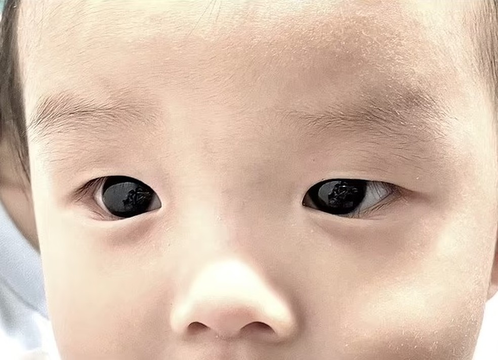 Os olhos do bebê eram castanhos... — Foto: Reprodução/ Frontiers in Pediatrics