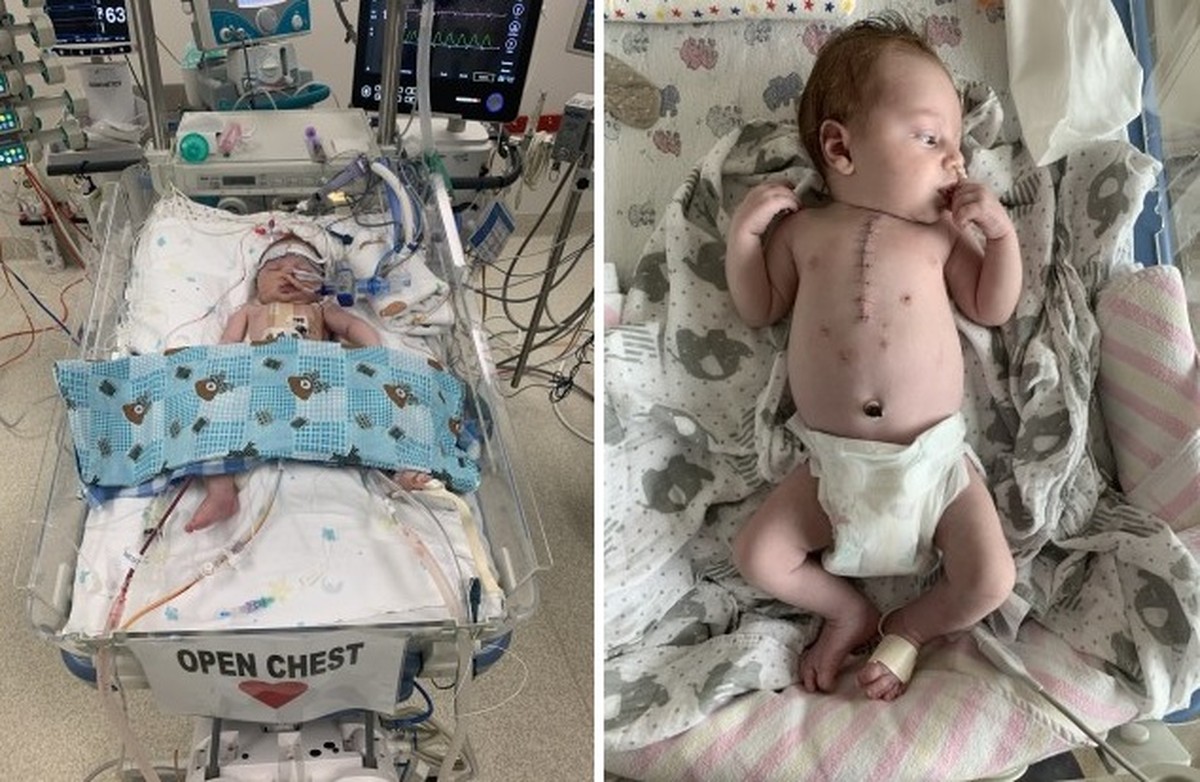 Bebê passa por duas cirurgias antes de completar seis meses