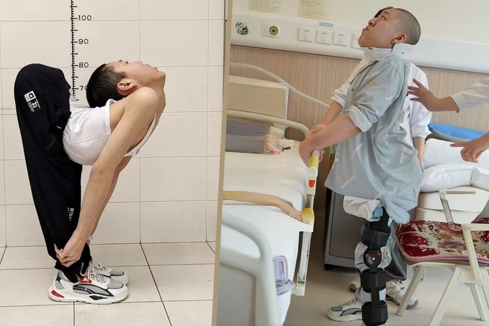 Menino Dobrado Antes E Depois