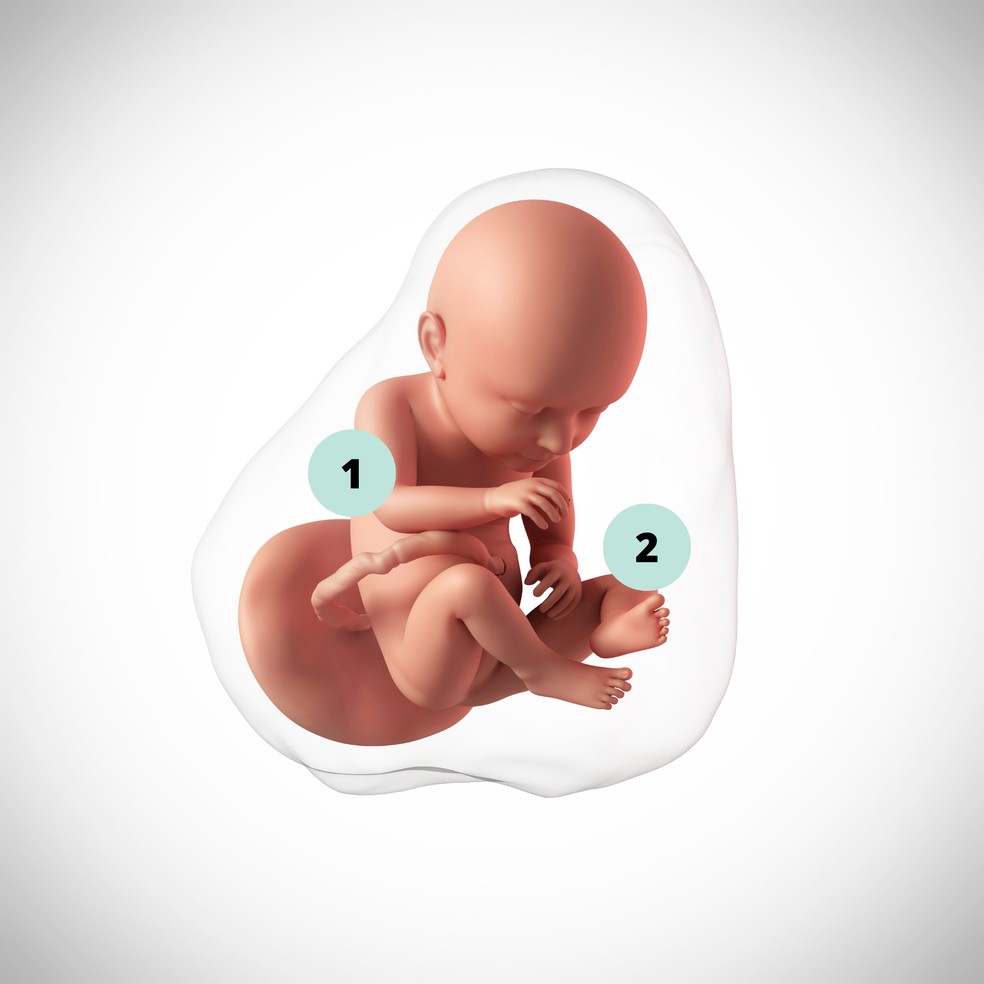 1. Com 37 semanas, o bebê não é mais considerado prematuro. Os órgãos estão formados, mas ainda precisam amadurecer, especialmente os pulmões; 2. Se o bebê estiver sentado (pélvico), a gestante pode considerar a possiibilidade de fazer a versão cefálica externa (VCE) — Foto: Getty Images