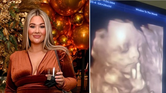 Mãe compartilha foto de bebê fazendo sinal "mal-educado" em ultrassom