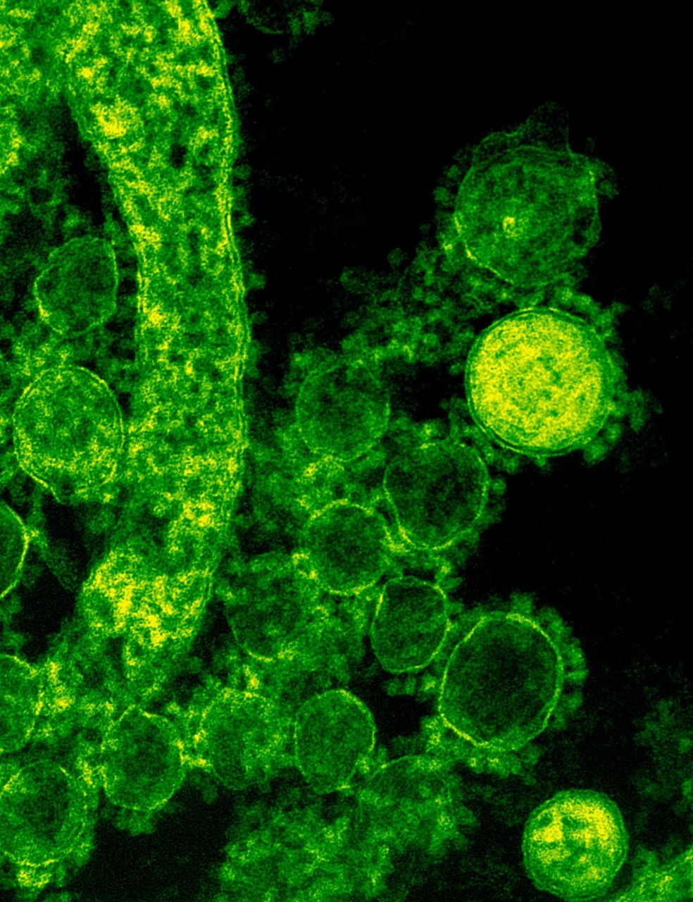 Os cientistas afirmam que descobriram um novo vírus em morcegos, com potencial para contaminar células humanas ou de gado — Foto: Pexels/ CDC