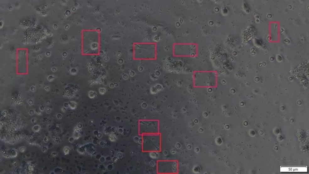 O sistema consegue buscar espermatozóides saudáveis em segundos — Foto: Reprodução/ BBC