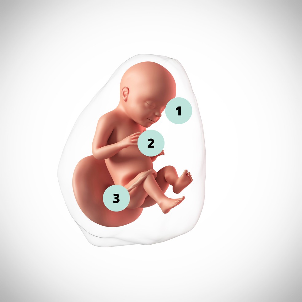 1. As pálpebras do bebê já são capazes de abrir e fechar; 2. O sistema nervoso central já pode conduzir movimentos respiratórios rítmicos; 3. Ainda há espaço para que o feto dê cambalhotas e mude de posição até a hora do parto — Foto: Getty Images