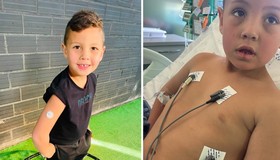 Menino tem diabetes tipo 1 descoberta após desmaio e mãe alerta: "Eu não sabia que criança podia ter diabetes"