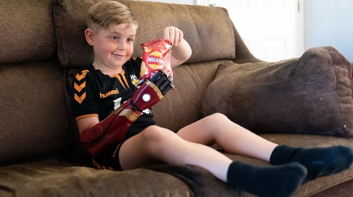 Boy without hands gets a robotic arm in the shape of Iron Man |  stay in