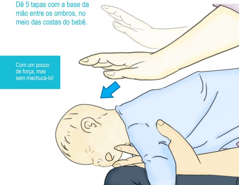 O que fazer quando seu bebê engasgar? (Foto: USP) — Foto: Crescer