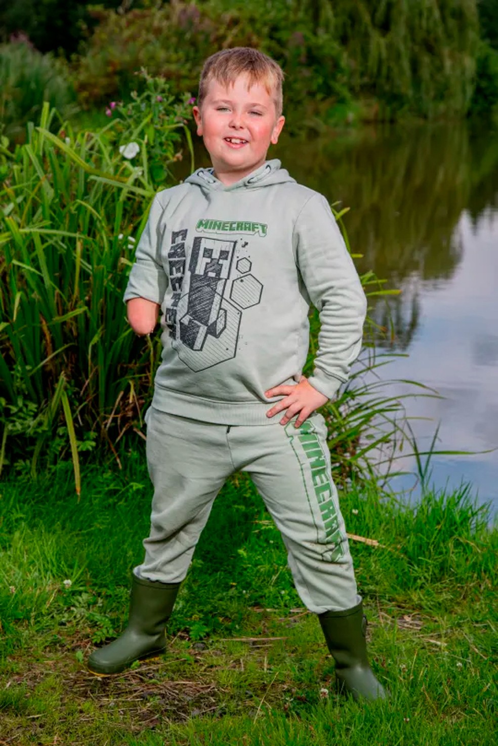 Alex Sparkes nasceu sem parte do braço direito — Foto: Reprodução/Metro