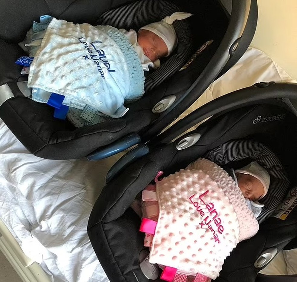 Quando recém-nascidos, os irmãos tinham mais semelhanças — Foto: Reprodução/ Daily Mail
