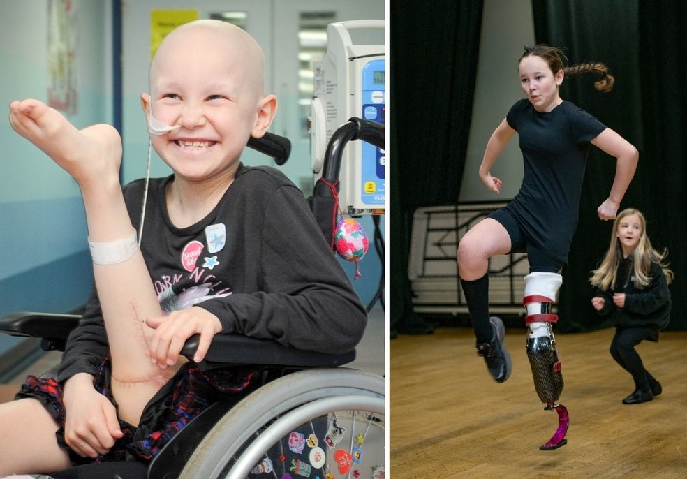Amelia, 12, corre e faz dança com sua nova perna protética — Foto: Reprodução/The Sun