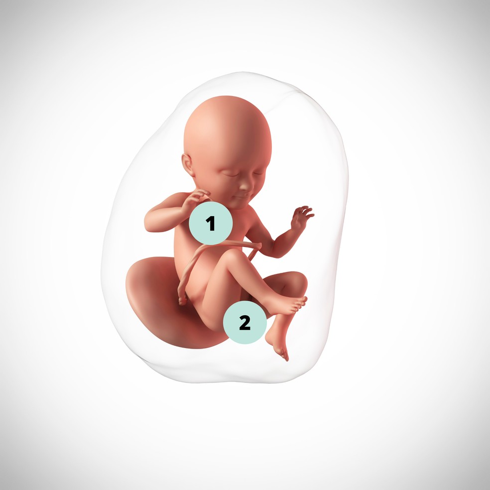 1. O vérnix caseoso engrossa e, em breve, ajudará na passagem do bebê pelo canal vaginal, durante o parto normal; 2. Em bebês meninos, ocorre a descida dos testículos do abdome para o saco escrotal — Foto: Getty Images