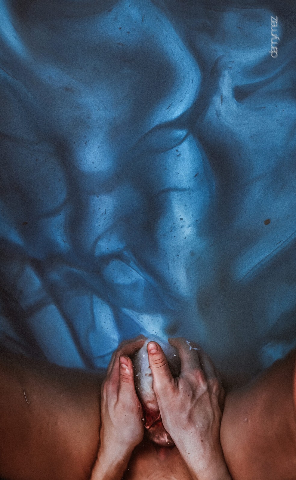 Melhor fotografia de parto (sa&iacute;da do beb&ecirc;): Fine Art &mdash; Foto: Danny Merz, da Geburtsreportage
