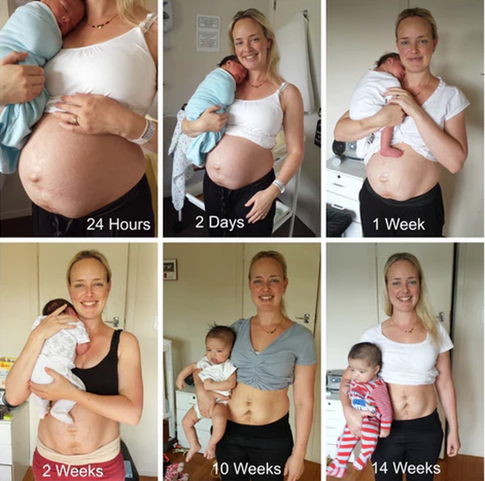 Como Perder Barriga Pos Parto
