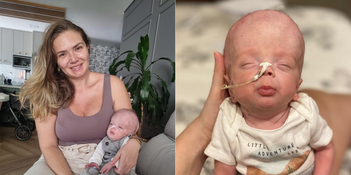 Mãe de bebê prematuro extremo relata a incrível jornada de superação do filho