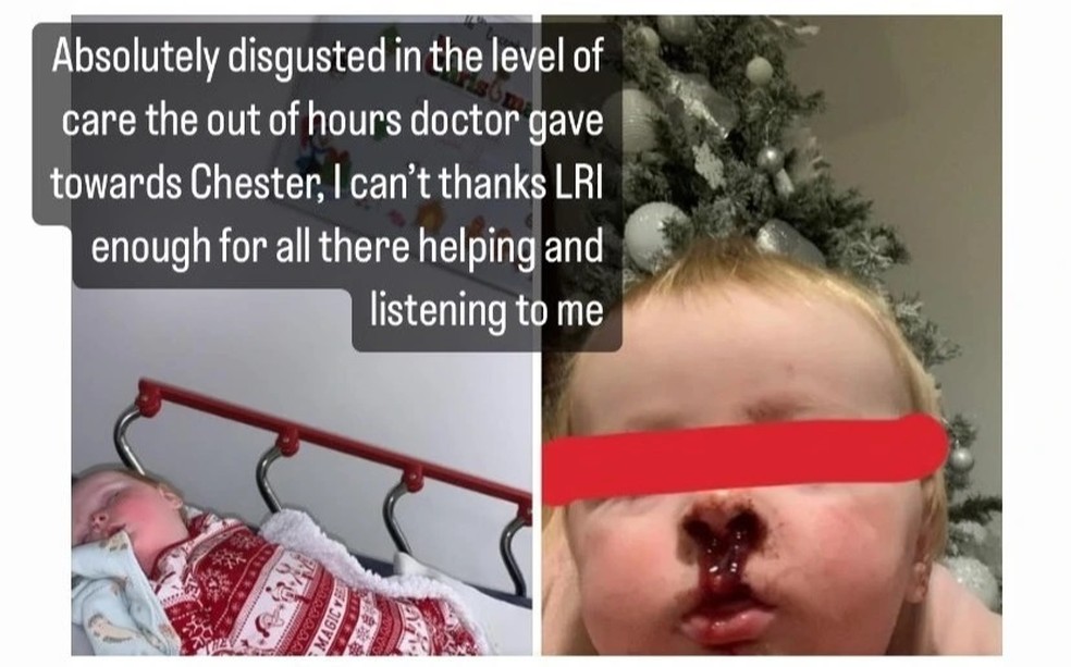 O pequeno estava com o nariz sangrando — Foto: Reprodução/ Instagram