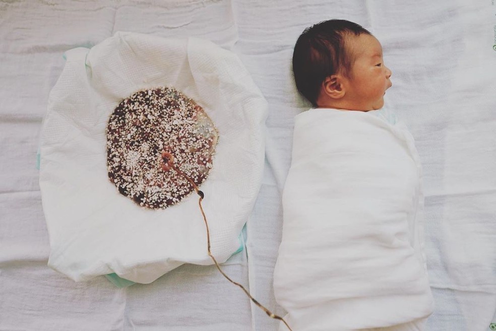 Parto de lótus, com bebê ainda conectado à placenta — Foto: Instagram/@april_with_baby