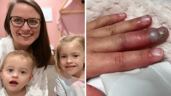 Menina, de 4 anos, quase perde a visão e o dedo no parquinho: 'Pode ...