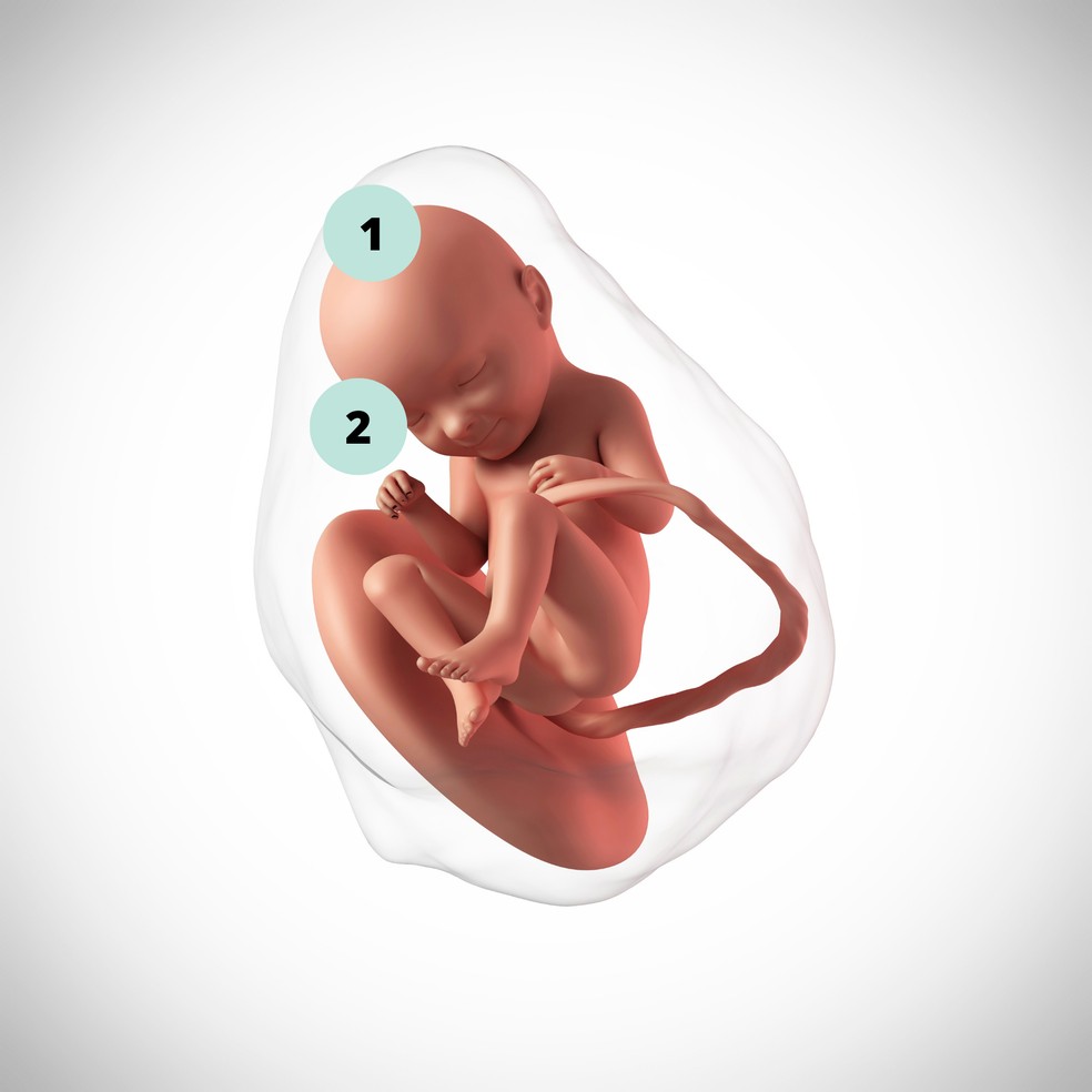 1. Os ossos do crânio ainda são mais flexíveis, para permitir a passagem do bebê pelo canal vaginal, durante o parto normal. 2. As pupilas do feto podem mudar de tamanho em resposta a um estímulo causado pela luz — Foto: Getty Images