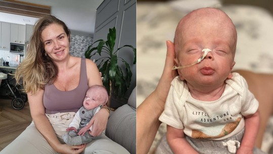 Mãe de bebê prematuro extremo relata a incrível jornada de superação e esperança com seu filho