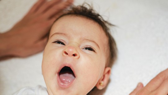 Teste da linguinha em recém-nascidos: quando a cirurgia de frenotomia é realmente indicada?