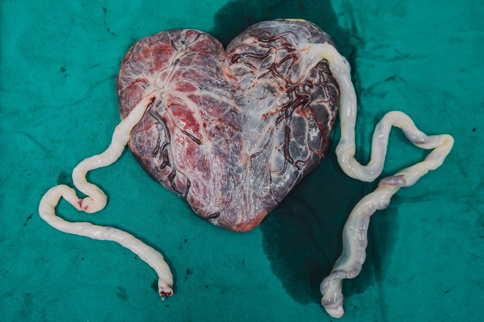 "Coração" de placenta — Foto: @brunacostafotografias