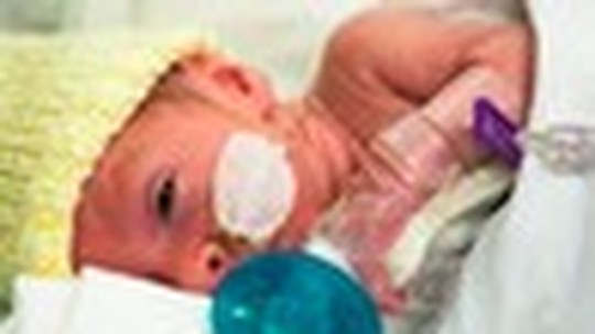 Prematuros: com quantas semanas um bebê é considerado "viável"?