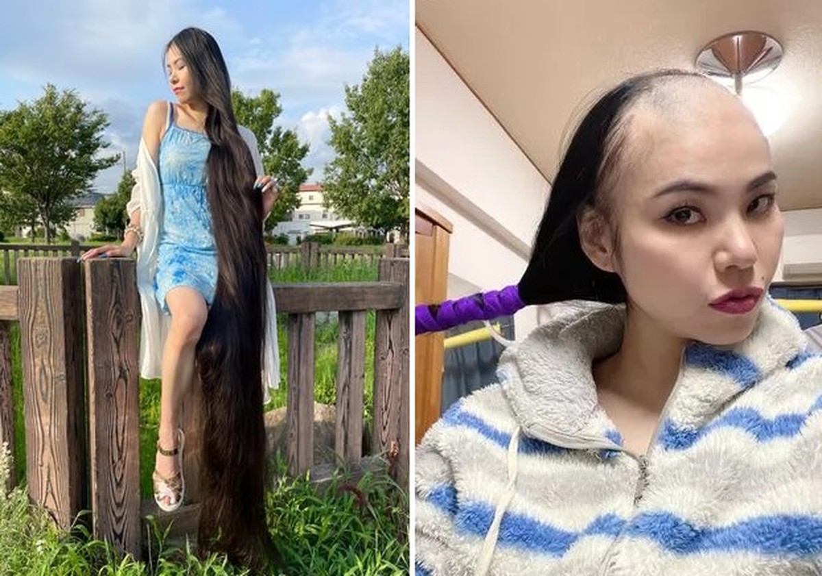 「現実のラプンツェル」、脱毛症と診断され2メートル以上の髪の毛を失う | にとどまる