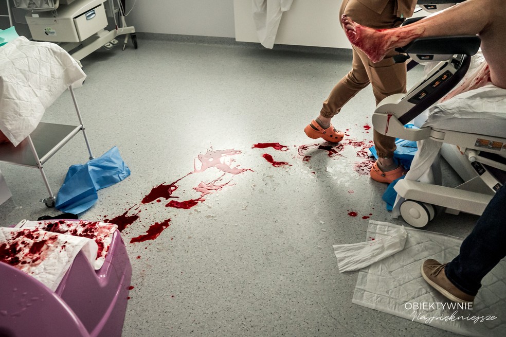 Melhor fotografia de parto na categoria detalhes &mdash; Foto: Ania Wibig, da Obiektywnie Najpiekniejsze