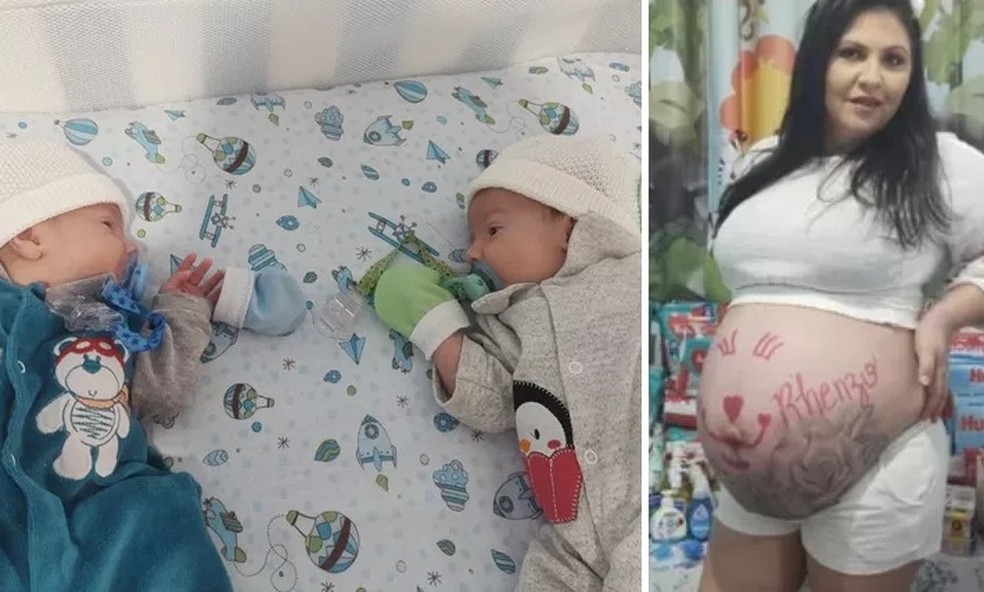 Veja como estão os gêmeos que perderam a mãe para covid logo após o parto:  'Ainda não sabem', diz pai