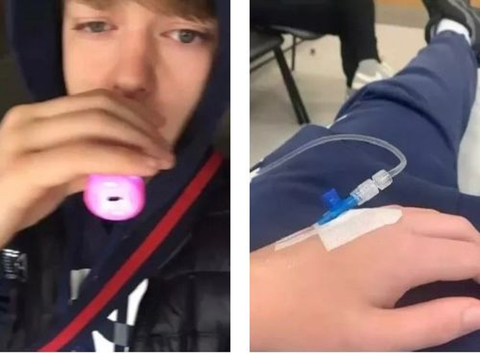 Jayden teve que ficar no hospital com danos pulmonares causados ​​por vaporização — Foto: Reprodução Mirror