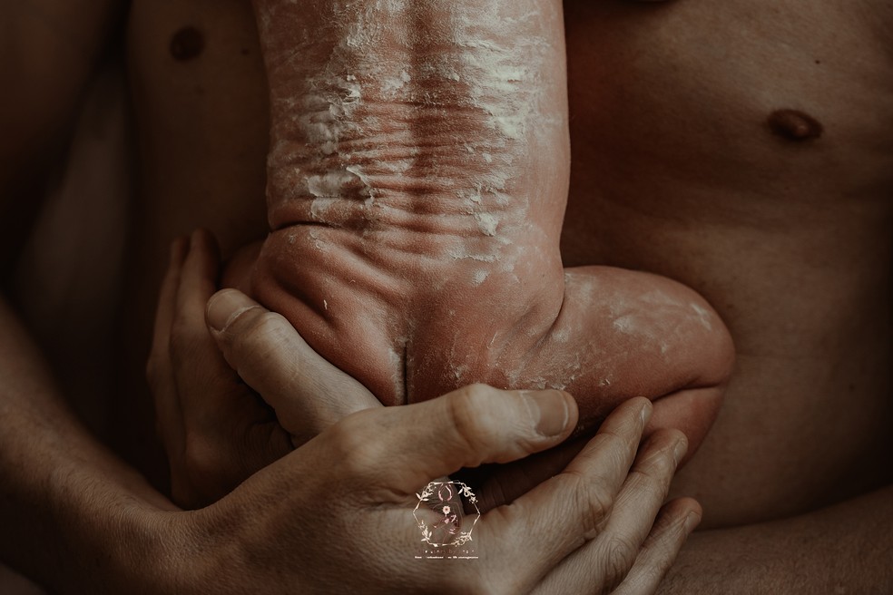 Melhor foto de parto categoria detalhe: Document&aacute;rio &mdash; Foto: Lesley Hoogendoorn
