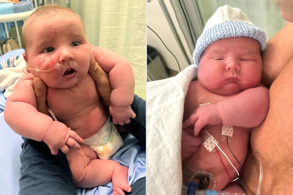 Grayson rec�m-nascido � Foto: Reprodu��o/People